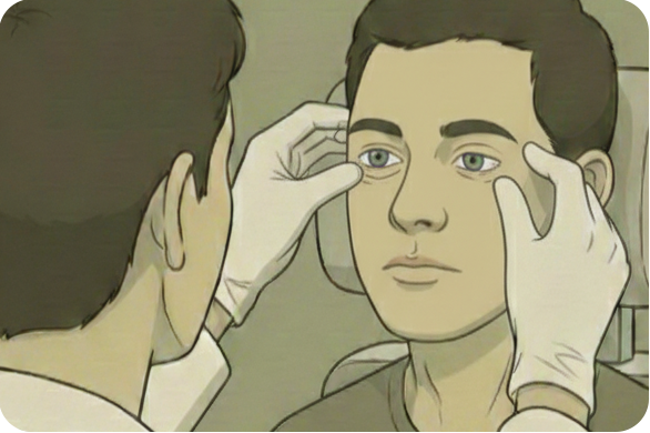 Meibomian gland expression assessment